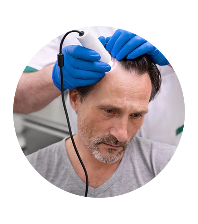 saç ekim merkezi teknikleri