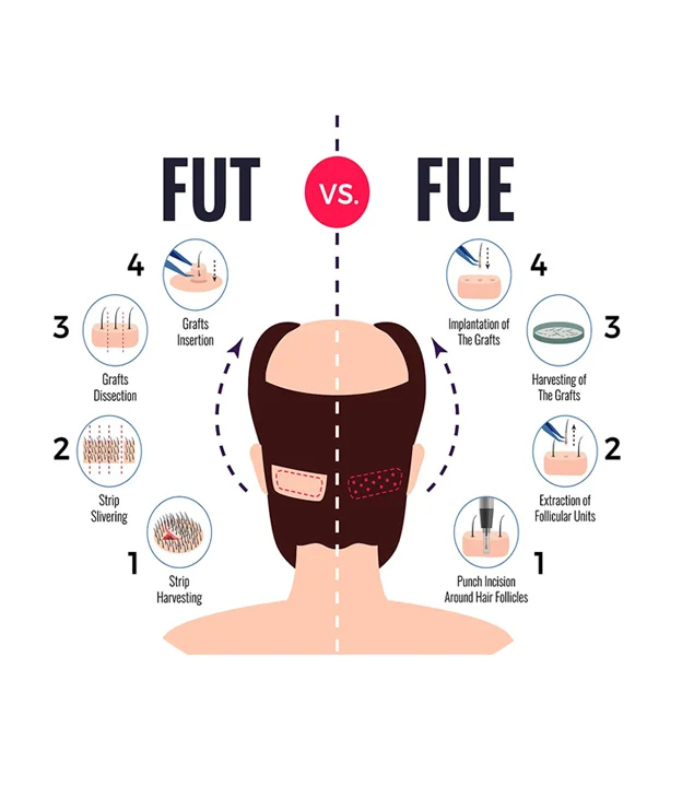 saç ekim merkezi web site içerikleri
